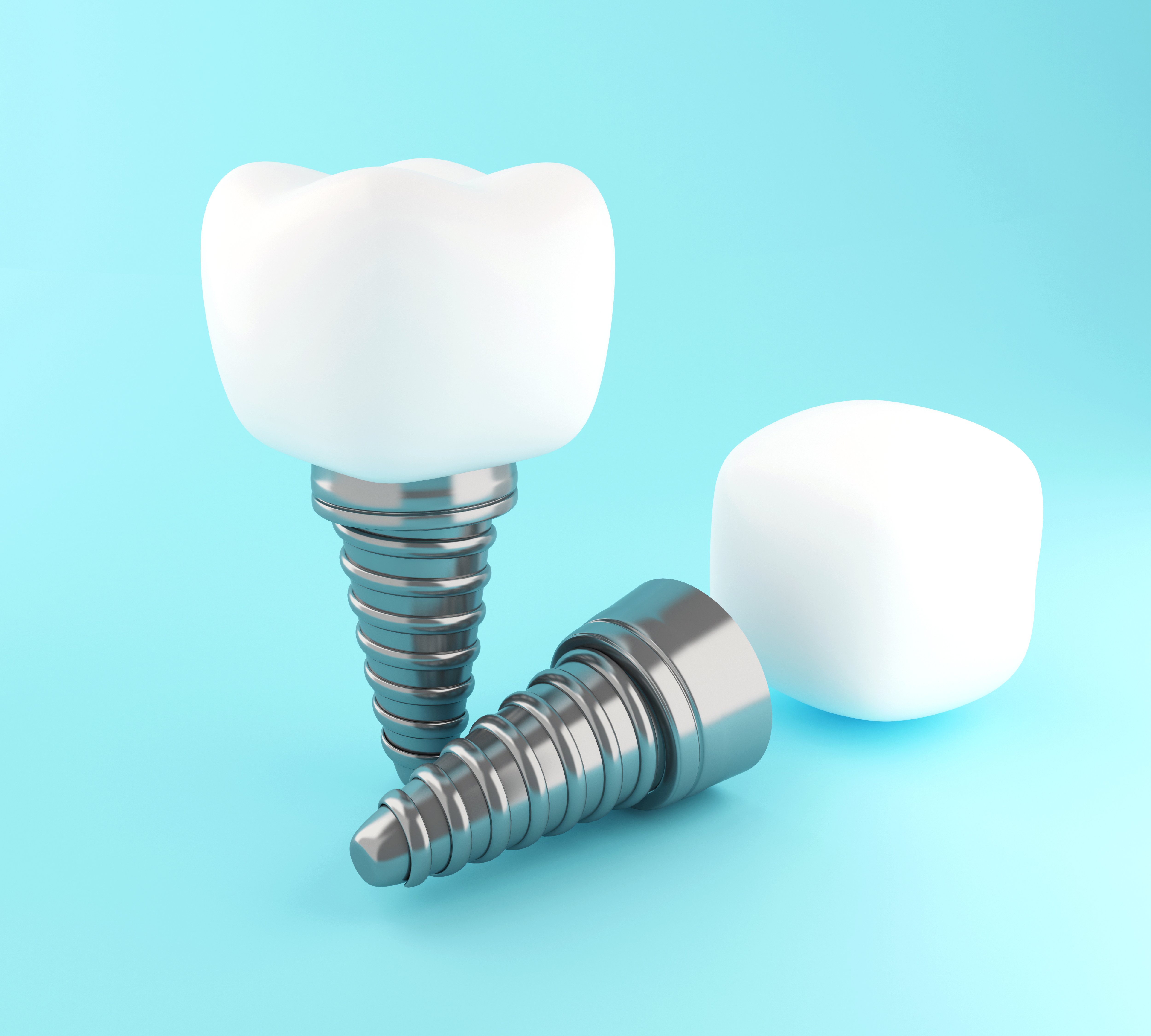 3D dental tooth implant