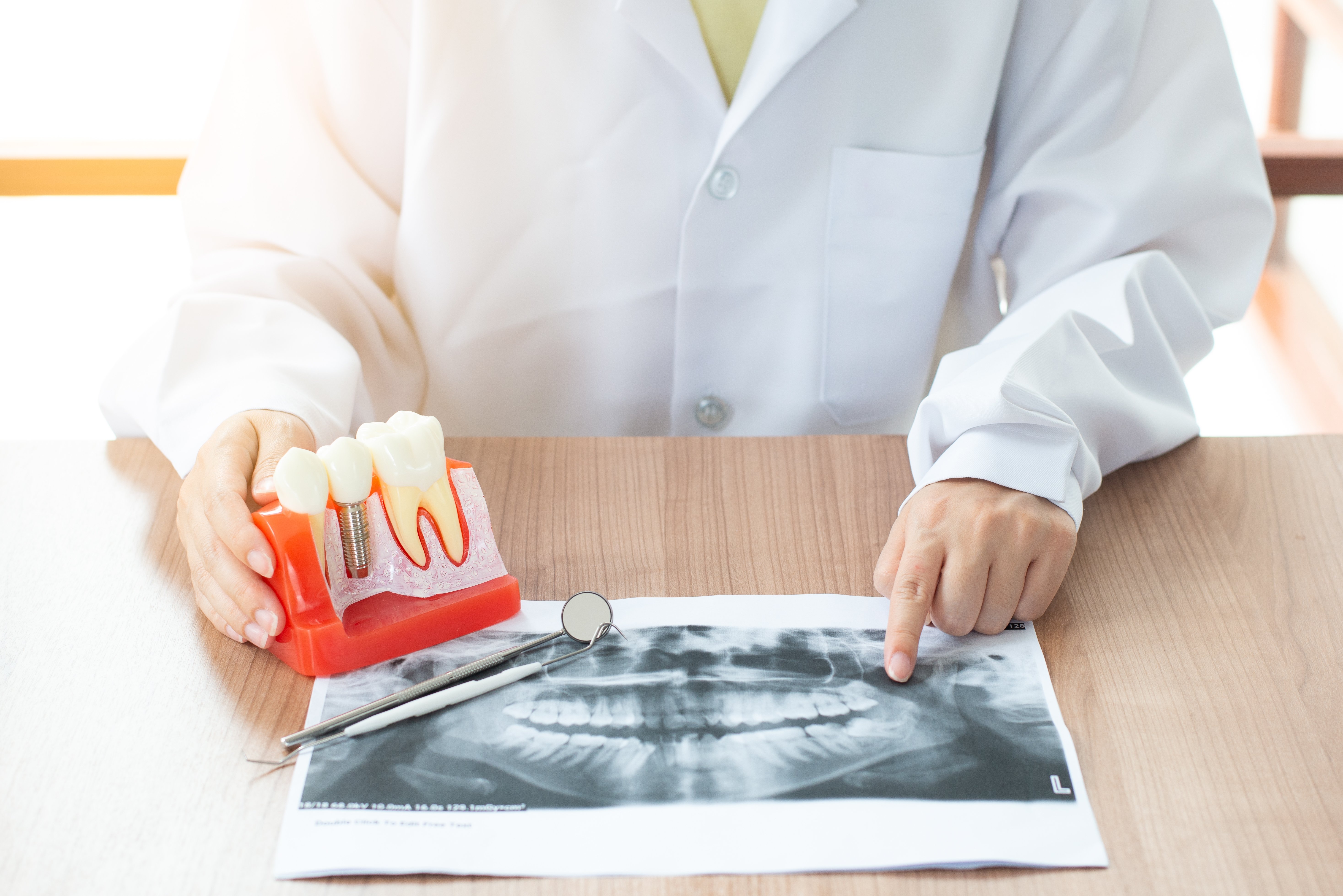 Dentist with dental implant model