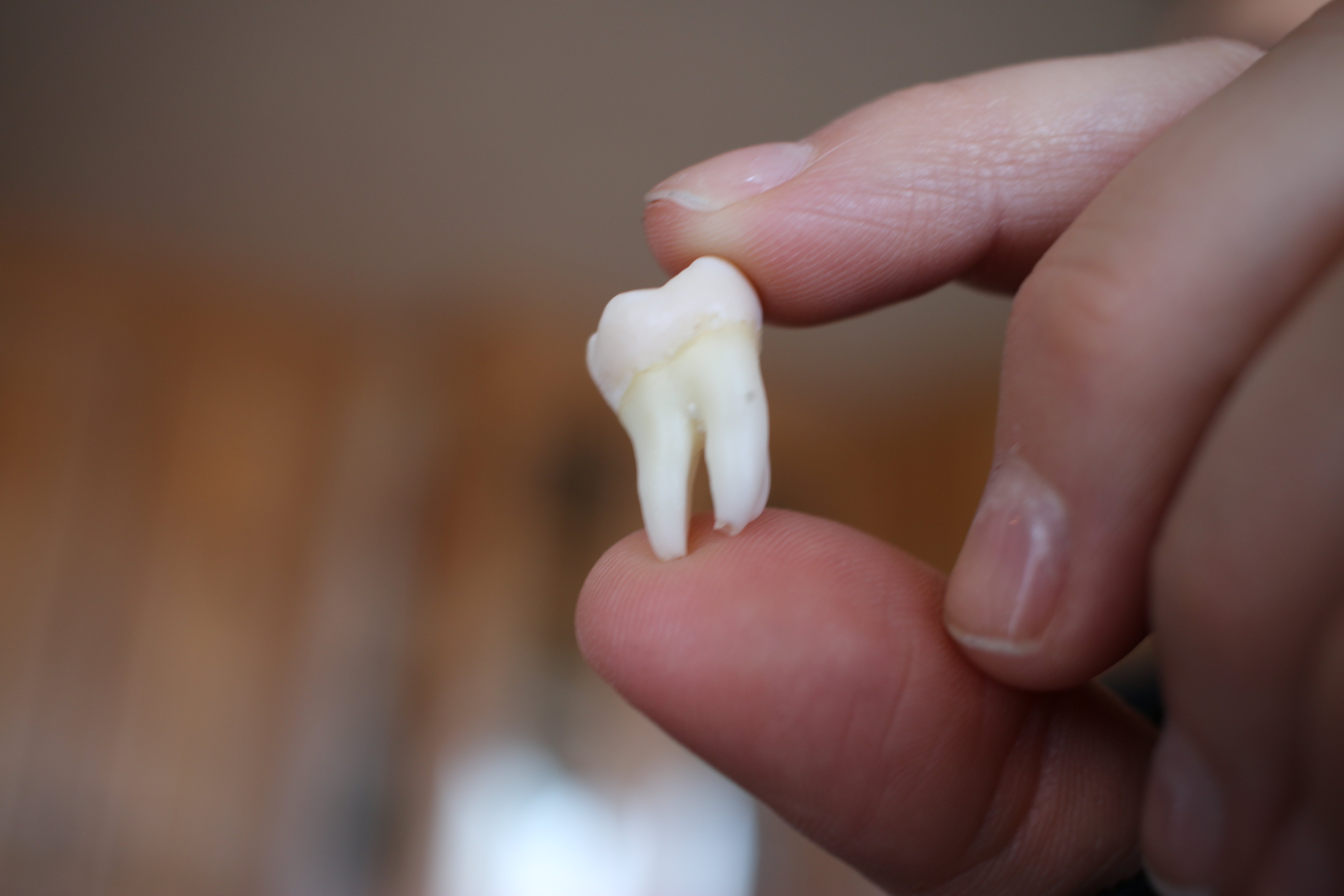 image-of-an-extracted-wisdom-tooth-K3P8B6S